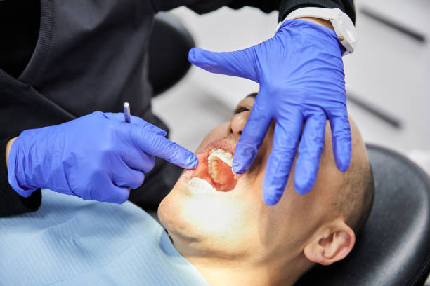 Best Broken or Cracked Tooth Emergency Dentist in Graham, TX