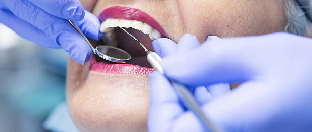 Best Emergency Dentist for Knocked-Out Tooth in Graham, TX